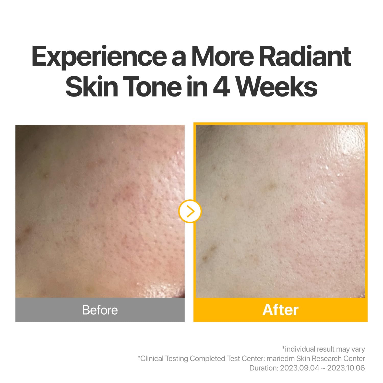 [Numbuzin] No.5+ Glutathione Vitamin Concentrated Mask (5ea)