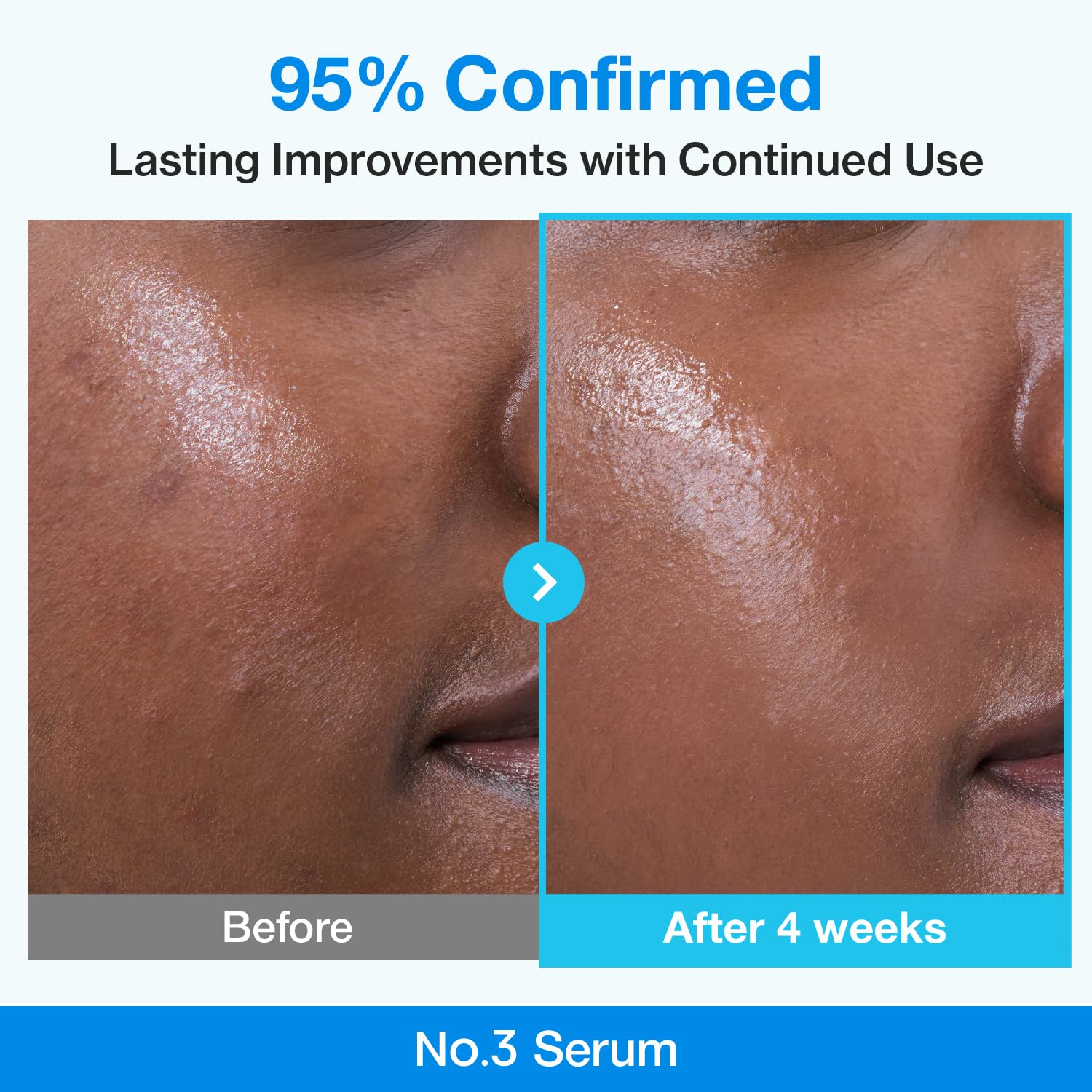 [Numbuzin] No.3 Blue Bio-Retinol Pore Refining Serum 1.01fl oz (30ml)