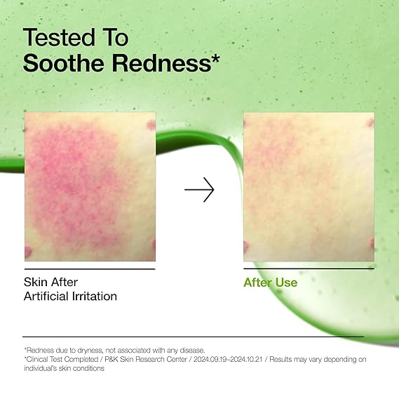 [Anua] Azelaic Acid 10 Hyaluron Redness Soothing Serum 1.01 fl oz (30ml)