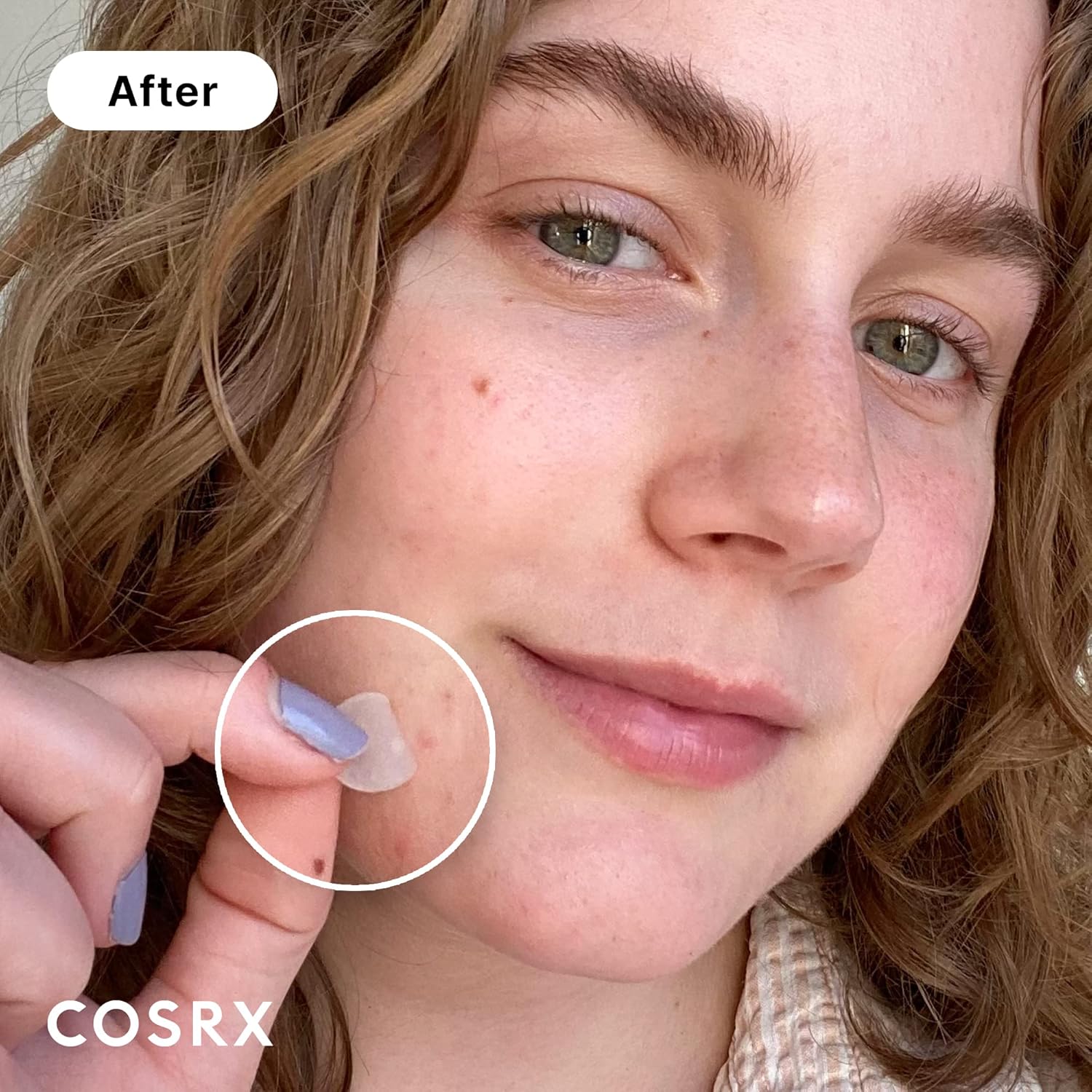 [COSRX] Acne Pimple Master 24patches