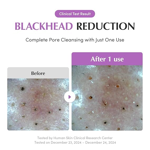 [EQQUALBERRY] Purple Rice Pore Purifying Pack Cleanser 4.58 oz (130g)